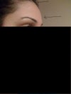 forehead flat, with depressions, hair line too high