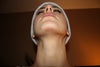 6 weeks post-op, uneven nostrils and 'leaning' nose.