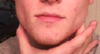 About the width I'd like my jaw to be. About as angular, if not more. Would still like chin augmentation, as well.