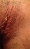 Notice raised areas on right side, labia majora