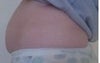 6 Months after