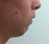 Profile of chin