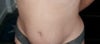 Tummy Before