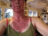 Day 4 ouch