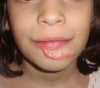 closer look of chin