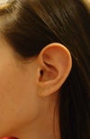 Left Ear