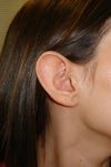 Right Ear