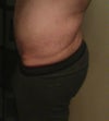 Side