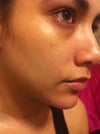 Taken today. You can see lines and fine wrinkling around my eyes, large pores around my nose and many deep lines around my neck.