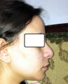 profile after