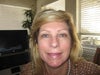 Pic #3 taken Feb 3, 2012.   hyaluronidase injected every week since 1/2/12 and I still do not look back to normal.  What can I do?