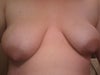 Left breast is a B-Cup
Right breast is a D-Cup