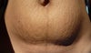Bottom