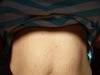 Upper top