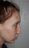 right side
