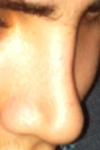 left side from top