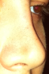 left side