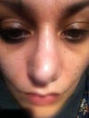 Very swollen and no shape at all