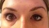 the left eye droop
