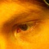 Left eye
