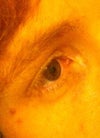 Right eye