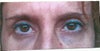 Black lower lids....