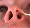 Look inside where he's pointing- exactly what I'm talking about. From my profile, this makes my nostril look really small. Credits to Dr. Denenberg.