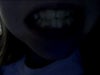 I PUT MY MOUTH LIKE THIS TO SHOW MY BOTTOM TEETH BETTER
