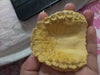 inner