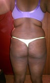 back