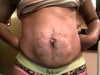front angle of tatoo