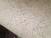 leg