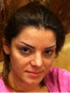 this is my face before the operation