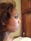 chin, jawline