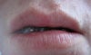 Photo of lips slightly open front facing