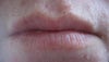 Photo of lips when closed
