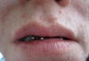 Photo of lips further away