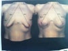 3d actual pic of chest