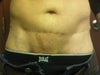 scar not even straight