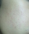 right cheek