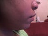I definitely feel like my chin is too small when I look at it from the side.  Not sure if loosing fat in my face would help with that?