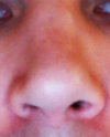More noticeable difference between sides,