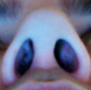 See left nostril. This is the flattest side...but on the inside of my nose I have a bump which was supposed to be a crust that would come out. I now think this is cartilage that was pushed too far down..this actually..partially blocks my nostril.