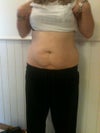 Front on - some stretch marks under belly button, only a couple on top. No loose skin I really hate that under the belly button buldge that looks like the letter W. Sorry about photo, daughter took so it's slightly blury.