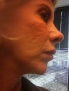right cheek