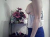 11 days Post Op