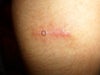 The bump is a bit hard to see but its circled thank you.