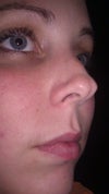 the side of my nose you can kind of see it in the picture but trust my the butt nose is severe