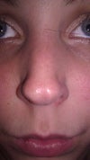from the front see the inner curve towards the back of my nose on the sides. This makes me scared its not fixable