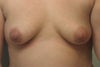 36B Now